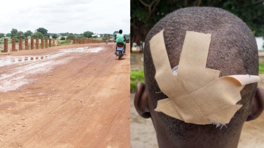 How Ghana’s debt crisis caused nightmares and injuries on Bolgatanga-Bawku road